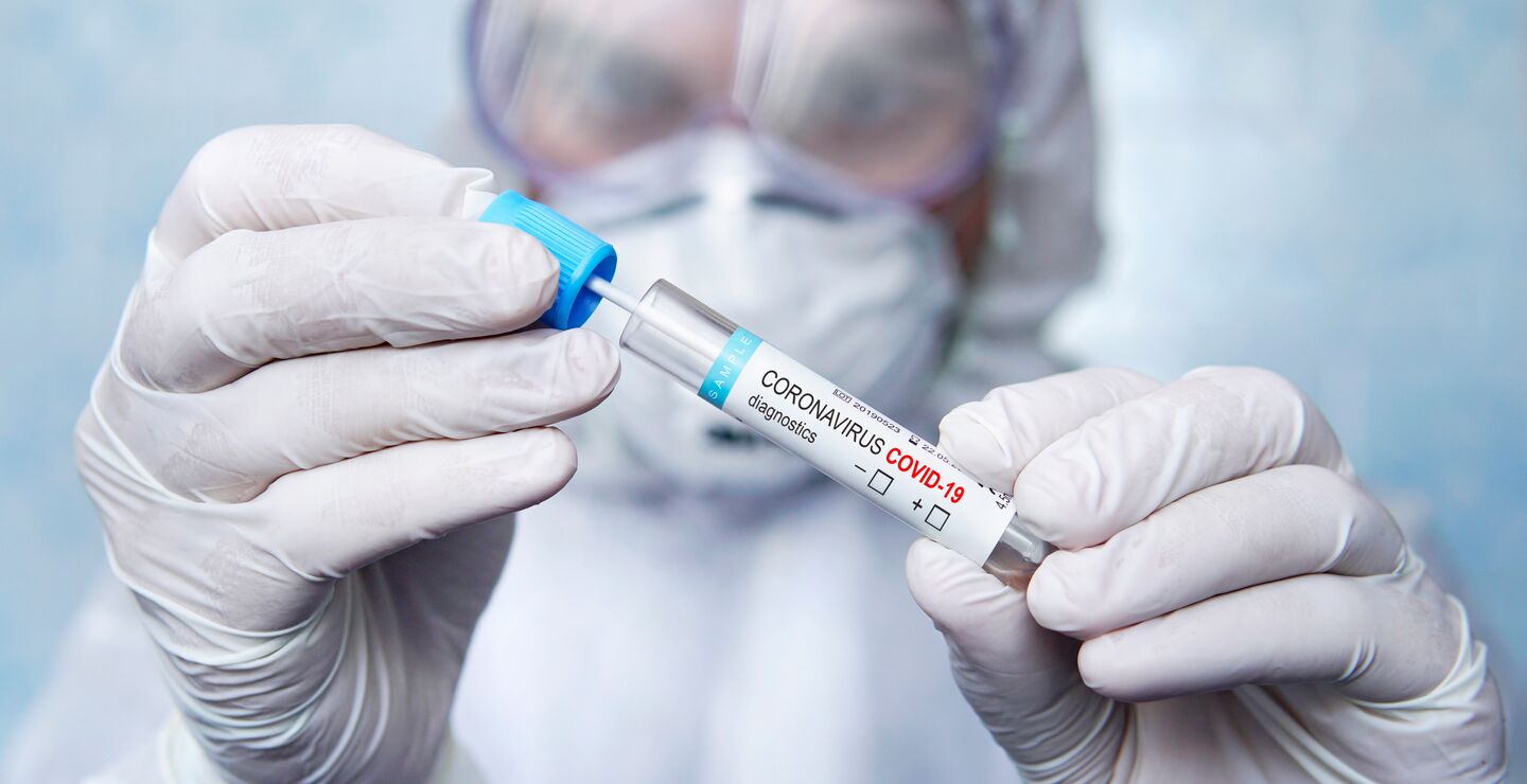 Det er som forventet at temperaturen stiger i markedet som skal fordele produserte vaksiner mellom land. Når de avtalte prisene varierer så mye mellom land, settes kontraktene med industrien på prøve, skriver professor Dag Morten Dalen. Bildet av en koronatest. (Foto: Dyi13)